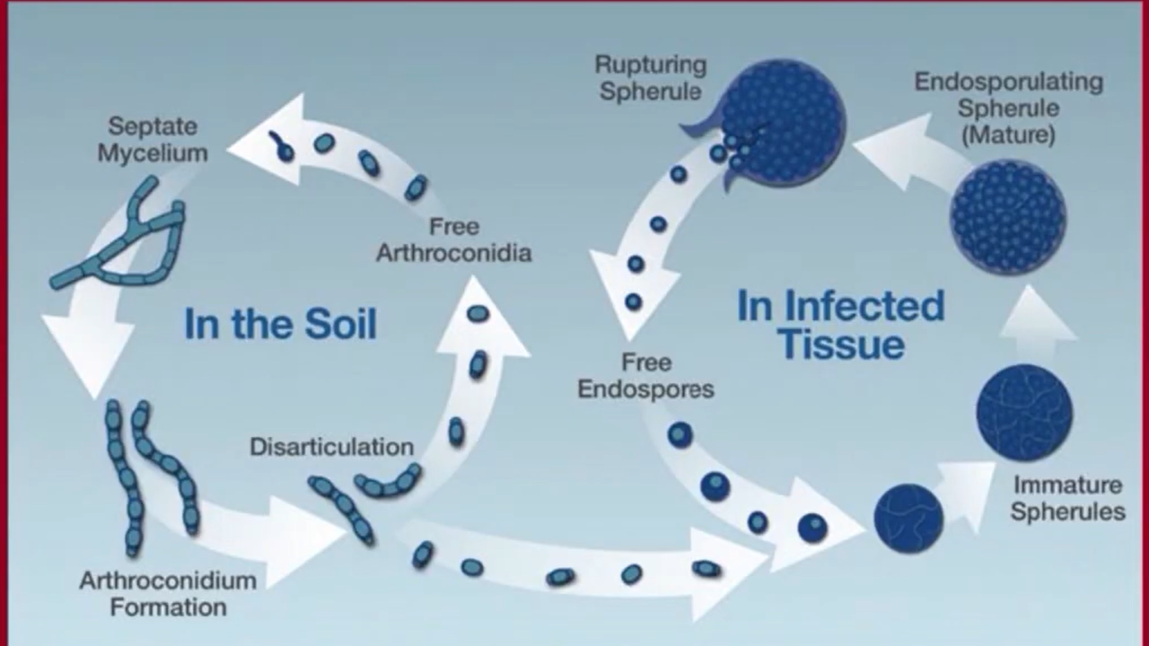 What is Valley Fever & Why is it on the Rise?